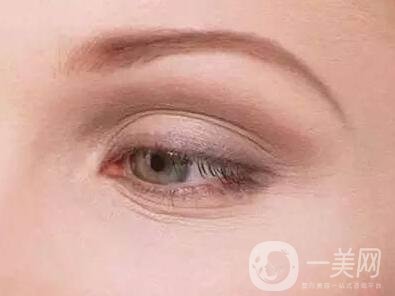 去除魚尾紋的方法有哪些？哪種方法比較好？