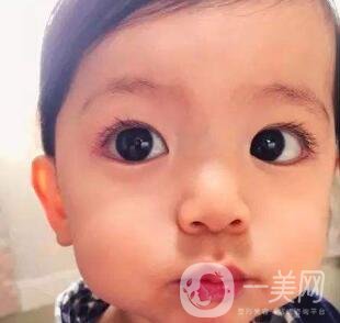 去頰脂墊價(jià)格貴嗎？大概價(jià)位是多少？