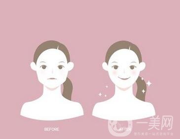 去頰脂墊有副作用嗎？術(shù)后如何護(hù)理可以減小副作用？