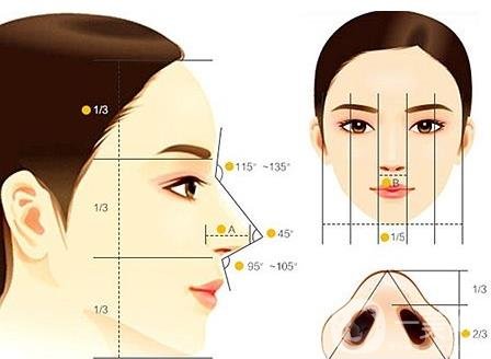 假體隆鼻整型術(shù)術(shù)前準(zhǔn)備有哪些？