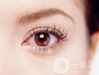 開眼角手術(shù)