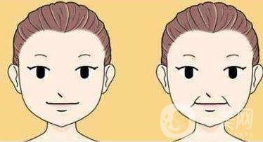 冰電波拉皮除皺*果如何？有哪些優(yōu)點(diǎn)？