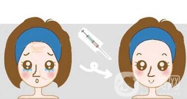 玻尿酸保持時間是多久？如何延長保持時間？