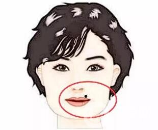 點痣后注意事項一定要遵守，否則會留疤！