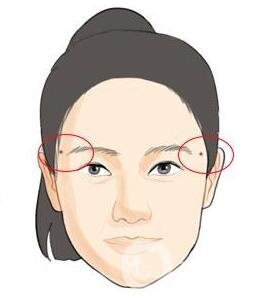 點痣后注意事項一定要遵守，否則會留疤！