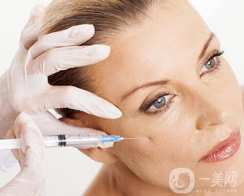 *祛皺紋能保持多久?有副作用嗎?