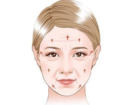 *祛皺紋能保持多久?有副作用嗎?