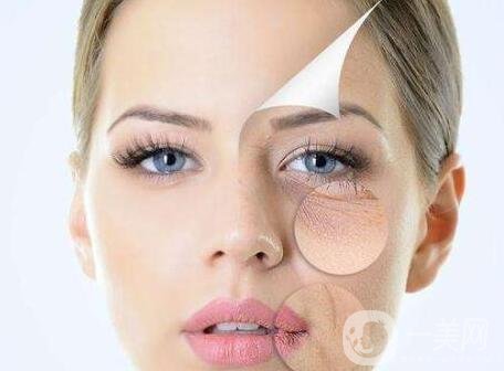 *去皺多久打一次?*果好嗎?