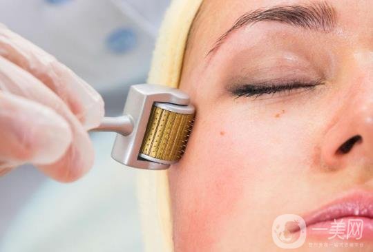 果酸換膚一次多少錢？要做幾次才*？