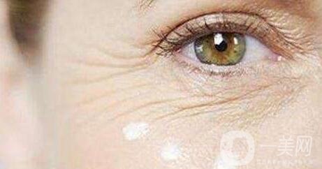 注射去魚(yú)尾紋