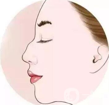 如何讓鼻梁變高？可以注射玻尿酸嗎？