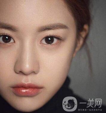 如何讓鼻梁變高？可以注射玻尿酸嗎？