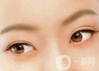 三點定位雙眼皮手術(shù)后應(yīng)該注意些什么？