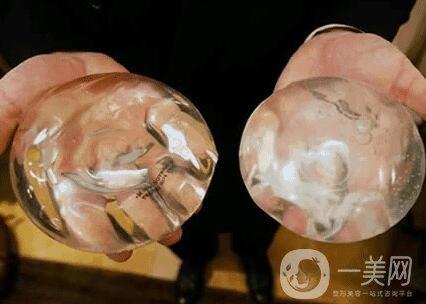 胸部整形術要多少錢?大概價位說明