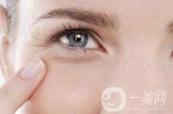 魚(yú)尾紋除皺手術(shù)哪種方法見(jiàn)*比較快?