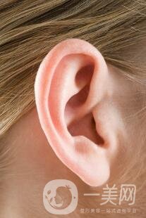 招風(fēng)耳手術(shù)多少錢?醫(yī)院收費(fèi)情況說明