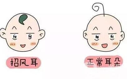 招風(fēng)耳手術(shù)多少錢?醫(yī)院收費(fèi)情況說明