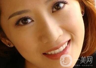 墊個鼻子要多少錢？大概價位是多少？