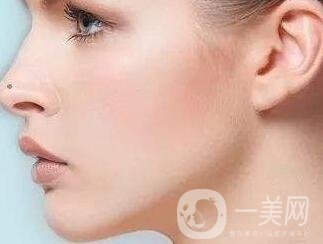 墊個鼻子要多少錢？大概價位是多少？