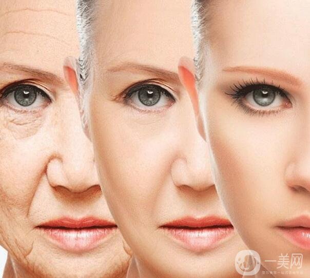 *祛皺對(duì)法令紋*嗎?能保持多久?