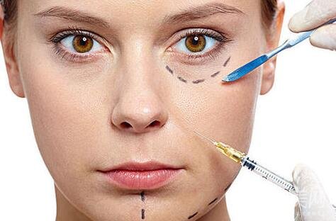 *祛皺對(duì)法令紋*嗎?能保持多久?