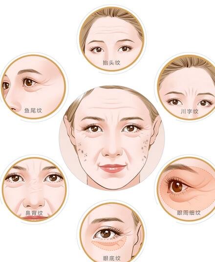 *去皺多久能見*?*果能維持多久?