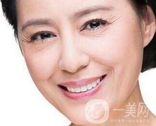 *去皺多久能見*?*果能維持多久?