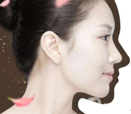 韓式立體隆鼻術(shù)的*果怎么樣？