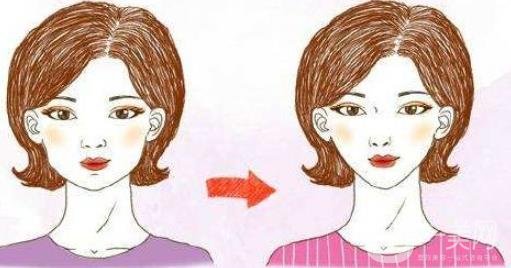 聚能吸脂的優(yōu)缺點盤點