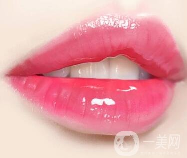 豐唇手術(shù)價(jià)格貴不貴？要多少錢？