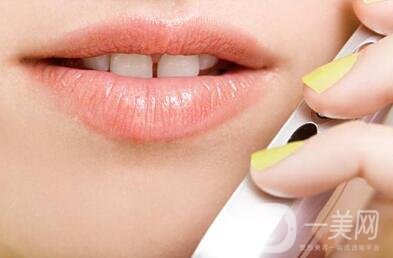 豐唇手術(shù)價(jià)格貴不貴？要多少錢？