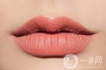 豐唇手術(shù)價(jià)格貴不貴？要多少錢？