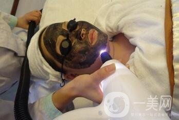 黑臉娃娃能去黑頭嗎？