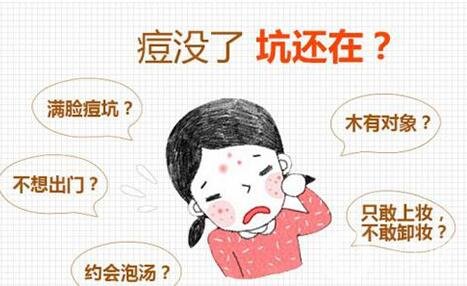 果酸換膚后注意事項有哪些?