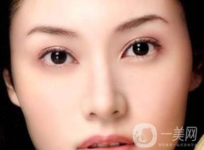 吸雕雙眼皮手術(shù)是什么？是埋線嗎？