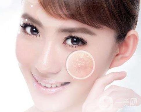 像素激光去痘的*果好嗎？會反彈嗎？