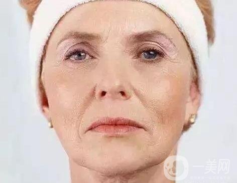 *去法令紋*果嗎?真的好嗎