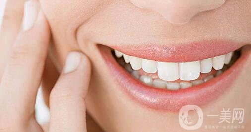 烤瓷牙的種類有哪些?哪種比較好?