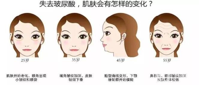 注射瑞藍(lán)玻尿酸價(jià)格是全國統(tǒng)一的嗎?有哪些區(qū)別