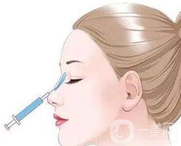 瑞蘭玻尿酸注射除皺*果怎么樣？