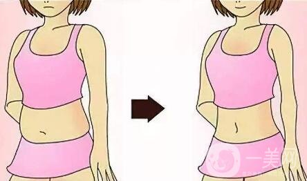 什么是環(huán)形吸脂減肥？?jī)?yōu)點(diǎn)有哪些？