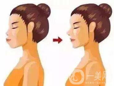 雙頜前突帶牙套可以矯正嗎？