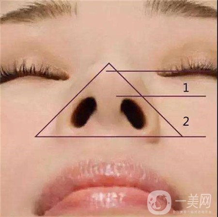 鼻頭縮小手術(shù)價錢大概是多少？