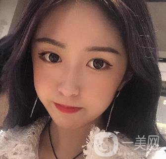 西安葉子整形美容醫(yī)院雙眼皮