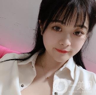 蘭州美奧整形醫(yī)院耳軟骨隆鼻