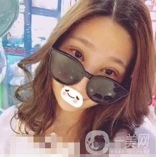 濟南旭美整形醫(yī)院靠譜嗎?附雙眼皮案例和全新價格表