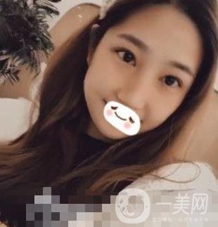 濟南旭美整形醫(yī)院靠譜嗎?附雙眼皮案例和全新價格表