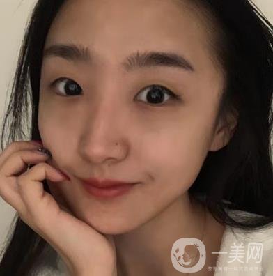 吉大一院整形外科價(jià)格表明細(xì)公布，隆鼻紀(jì)實(shí)案例分享