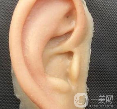 2020年石家莊第(一)醫(yī)院整形美容科價(jià)格表和耳朵畸形修復(fù)案例一覽