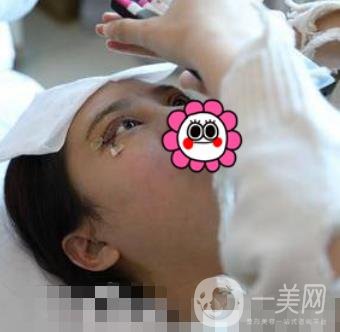 溫嶺芘麗芙整形醫(yī)院2020年價格表更新_雙眼皮整形*果實拍